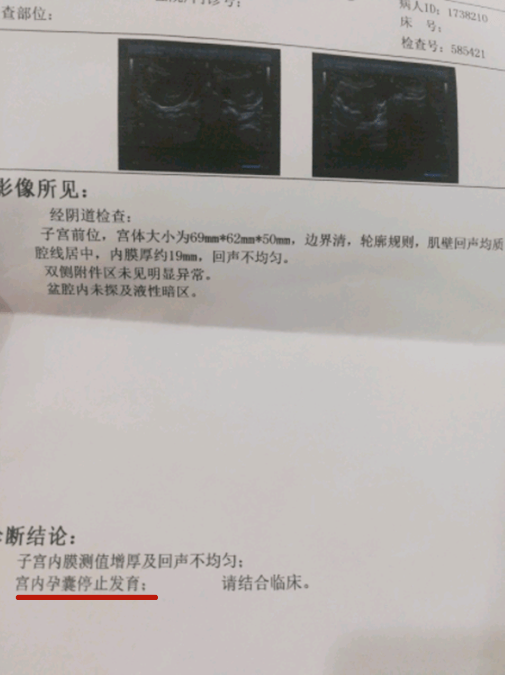 二十九周，揭示怀孕或孕期中的时间长度